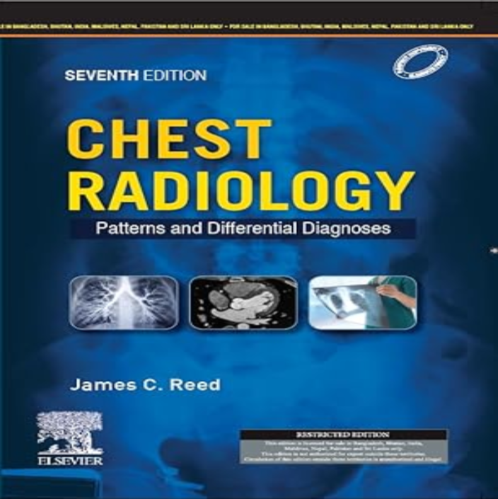 Chest Radiology: Patterns and Differential Diagnoses, 7e